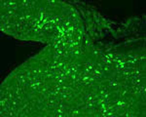 The cryostat section of the sheep hypothalamus was incubated in guinea pig polyclonal antibodies to the gamma melanocyte-stimulating hormone at the dilution of 1:1000 overnight followed by incubation with FITC- conjugated secondary antibodies. Cell bodies and nerve terminals in the sheep brain are intensely stained.