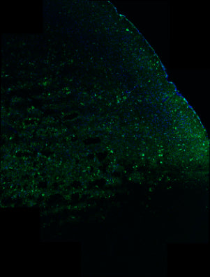 Immunostaining of 5xFAD mouse brain section fixed in 4% paraformaldehyde and preserved in cryoprotectant showing specific detection of IBA1 positive cells (cat. IBA1, 1:100; green) in the cortex. Nuclei stained with DAPI (blue). Background stain was attenuated with TrueVIEW. Image kindly provided by Ifeoluwa (Hiphy) Awogbindin of the Tremblay Lab, Division of Medical Sciences, University of Victoria, Canada.