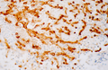Endogenous Peroxidase Block