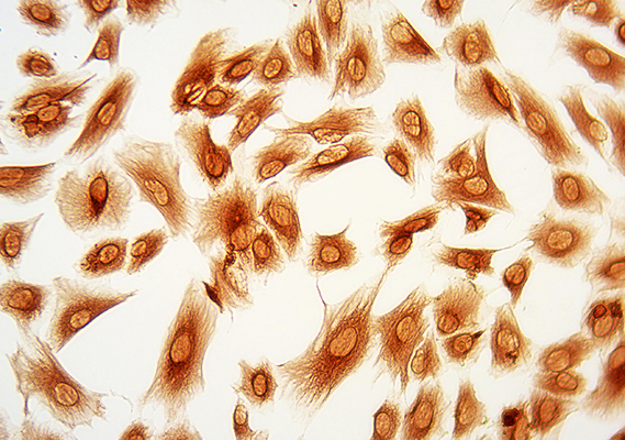 Streptavidin Conjugated with Allophycocyanin (APC)