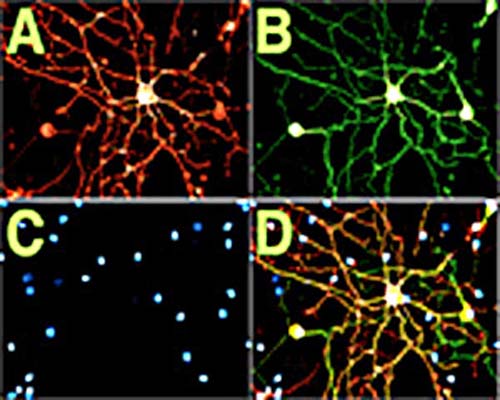 Immunofluorescent detection of p75NTR in cultured rat dorsal root ganglion (DRG). (A) Detection of p75NTR using mouse monoclonal antibody to rat p75NTR [MC192] M-006-100. (B) Detection of betaIII-Tubulin. (C) DAPI staining. (D) Merged A, B and C.