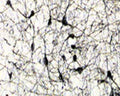 Immunohistochemical staining of p75NTR in rat forebrain using mouse monoclonal antibody to rat p75NTR [MC192], catalogue number M-006-50. Paraformaldehyde fixed rat brain sections were incubated with 1 µg/mL antibody overnight, followed by incubation with biotinylated rabbit anti-mouse IgG conjugate. The immunocomplex was then visualised with DAB . Neurons, in the septal nuclei of basal forebrain, known to be cholinergic neurons, show strong staining for p75NTR.