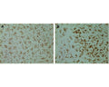 Photomicrographs (40x magnification) of CD11b-labelled microglial cells in rat brain using OX42 antibody (1:200 dilution) and immunohistochemistry. A: Quiescent microglia show many branched processes and small cell soma in normal brain. B: Activated microglia appear hypertrophic, have shorter and thicker processes and stain more intensely for CD11b. Brain tissue was fixed with 4% paraformaldehyde. 3,3&#8242; diaminobenzidine hydrochloride (DAB) was used as chromogenic substrate. Pictures courtesy of Dr Indrajeet Rana.