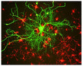 Image of a neuron in cell culture, derived from adult rat cortex, by Immunofluorescence and Immunohistochemistry. The large middle cell is stained with M-1391-50, Neurofilament light polypeptide (NF-L), Clone DA2, Mouse mAb, (green), and co-stained with product R-1379-50, Alpha-internexin, Rabbit pAb, (red). The culture was grown under conditions to induce neuronal survival and differentiation, and product R-1379-50 highlights a network of small neurons at early stages of differentiation.