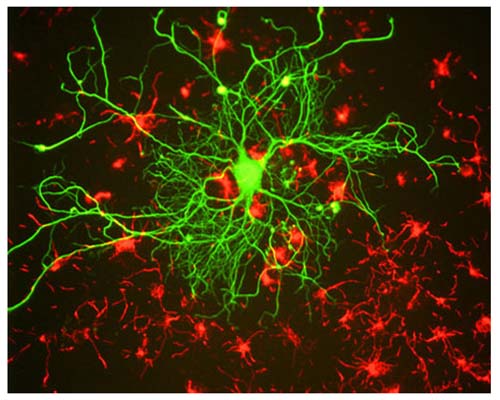 Image of a neuron in cell culture, derived from adult rat cortex, by Immunofluorescence and Immunohistochemistry. The large middle cell is stained with M-1391-50, Neurofilament light polypeptide (NF-L), Clone DA2, Mouse mAb, (green), and co-stained with product R-1379-50, Alpha-internexin, Rabbit pAb, (red). The culture was grown under conditions to induce neuronal survival and differentiation, and product R-1379-50 highlights a network of small neurons at early stages of differentiation.
