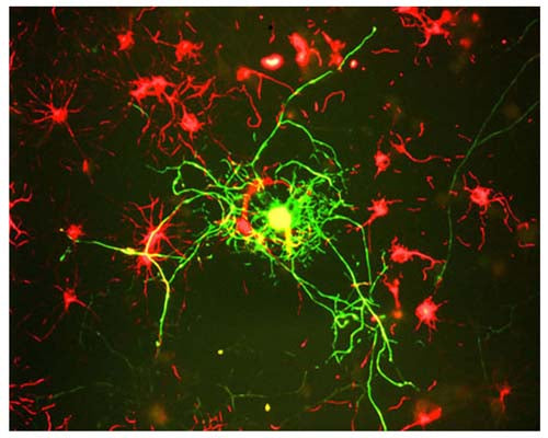 Image of a neuron and surrounding cells in cerebral culture, derived from adult rats, by Immunofluorescence and Immunocytochemistry. The cells were stained with M-1394-100, Neurofilament medium polypeptide (NF-M), Clone 3H11, Mouse mAb, (green), and co-stained with product R-1379-50, Internexin alpha, Rabbit pAb, (red). Mature neurons can be identified by their morphology and because they stain strongly with antibodies to NF-L, NF-M and NF-H (green). The surrounding mitotic neuronal progenitor cells (red) express many other neuronal markers.