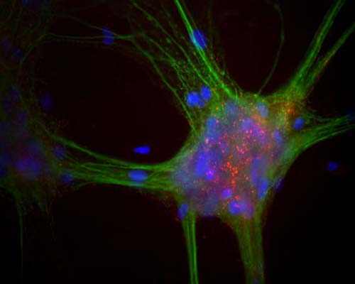 Mixed neuron-glial cultures stained with Mouse monoclonal antibody to alpha Synuclein [3H9] M-1402-100 (red) and Chicken polylclonal antibody to MAP2 C-1382-50 (green). The alpha Synuclein antibody stains vesicular structures the perikarya and processes of the neurons in this image.