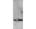 Western Blot image with Mouse monoclonal antibody to alpha Synuclein [3H9] M-1402-100 on recombinant alpha-synuclein (left lane) and crude extract of mouse brain (right lane). Image courtesy Rogan Tinsley, Howard Florey Institute, University of Melbourne).