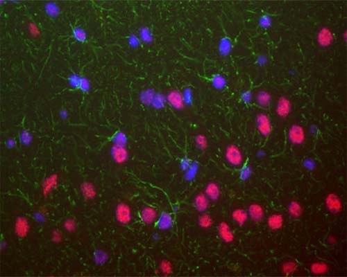 Mouse monoclonal antibody to TAR DNA-binding protein 43 [3H8] M-1403-100 was used to stain a section of formalin fixed adult rat brain, specifically the hippocampus. Hippocampal neuron nuclei are stained strongly. Chicken polyclonal antibody to GFAP C-1373-50 (green) shows the processes of astrocytic glial cells. Nuclei of all cells are revealed with DAPI DNA stain (blue). The TAR DNA-binding protein 43 antibody stains neuronal nuclei strongly and the nuclei of some non-neuronal cells much more weakly. Neuronal nuclei therefore look crimson, since they are both red due to the content of TAR DNA-binding protein 43 and blue due to their content of DNA, stained blue with DAPI.