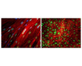 TDP43 staining in fixed and permeabilized human umbilical vein endothelial cells (HUVEC) by Immunocytochemistry. TDP43-IR (green) is localized to cell nuclei as expected. Blue: Hoechst nuclear stain (left only). Red: Phalloidin staining. Primary TDP43 antibody concentration: 2 µg/mL; Magnification: 32X. Image courtesy of QBM Cell Science.
