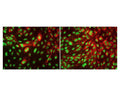 TDP43 staining in fixed and permeabilized human umbilical vein endothelial cells (HUVEC) by Immunocytochemistry. TDP43-IR (green) is localized to cell nuclei as expected. Red: Staining of von Willebrandt factor. Primary TDP43 antibody concentration: 2 µg/mL; Magnification: 32X. Image courtesy of QBM Cell Science.