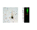 Left: Analysis of ubiquitin expression (brown) in FFPE section of human cerebral cortex of an Alzheimer patient by Immunohistochemistry. Signal was generated with DAB. Counterstain: haemotoxylin (blue). A typical flame-shaped tangle is seen in a pyramidal neuron in the center and is surrounded by dystrophic neurites, also strongly ubiquitin-positive. Both are commonly seen in cortical and hippocampal Alzheimer brain sections and are typical for this disease, but are rare or absent in healthy brain. Right: Western blot analysis of HEK293 cell lysates for ubiquitin expression (green, 1:1,000). [1] protein standard, [2] cells maintained in normal medium, [3] cells treated with 10 uM of proteasome inhibitor lactacystin (Lc) for 16 hours. The smear detected above the 200 kDa standard represents accumulation of ubiquitinated proteins in proteasome inhibitor-Lc treated cells. The prominent band at 8 kDa corresponds to monoubiquitin. The same blot was probed with an antibody to HSP60 as loading control.
