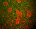An image showing a section of rat spinal cord stained with Mouse monoclonal antibody to Ubiquitin C Terminal Hydrolase 1 [BH7] M-1407-100 (red) and Rabbit polyclonal antibody to neurofilament H R-1388-50 (green). The large cells are a-motorneurons and Ubiquitin C Terminal Hydrolase 1 (UCHL1) fills the cytoplasm of their perikarya and dendrites. The neurofilament NF-H antibody binds primarily to phosphorylated axonal forms of NF-H, and so stains axons coursing between the large motor neurons.