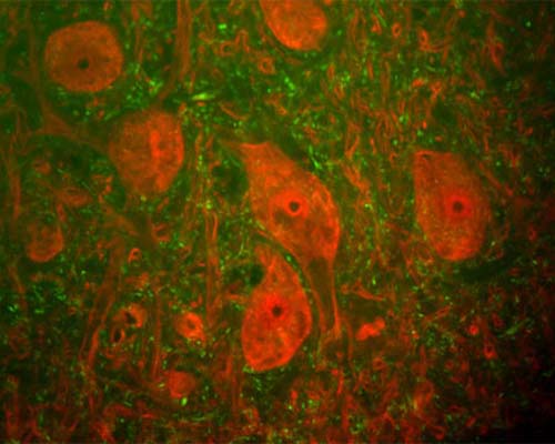 An image showing a section of rat spinal cord stained with Mouse monoclonal antibody to Ubiquitin C Terminal Hydrolase 1 [BH7] M-1407-100 (red) and Rabbit polyclonal antibody to neurofilament H R-1388-50 (green). The large cells are a-motorneurons and Ubiquitin C Terminal Hydrolase 1 (UCHL1) fills the cytoplasm of their perikarya and dendrites. The neurofilament NF-H antibody binds primarily to phosphorylated axonal forms of NF-H, and so stains axons coursing between the large motor neurons.