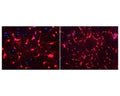 Ubiquitin C Terminal Hydrolase 1 staining (red) in hippocampal cultures by Immunocytochemistry. Primary antibody dilution: 1:2,000. Blue: nuclear stain. Image courtesy of QBM Cell Science.