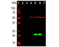 Western blot analysis of whole brain and cell lysates using mouse antibody to DJ1 (green, 1:5,000). [1] protein standard, [2] rat brain, [3] mouse brain, [4] NIH-3T3, [5] HeLa, [6] HEK293, and [7] C6 cells. The antibody detects DJ1 protein with apparent molecular weight of 21 kDa, but only in human cell lines, since it does not recognize the rat or mouse DJ1 protein. The blot was simultaneously probed with chicken antibody to vimentin (C-1409-50, red, 1:5,000), revealing a single band at about 50 kDa (lanes 2-7).