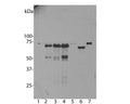 Western blot analysis of untransfected primary mouse neuron and glia cell cultures (lane 1), the same cells transduced with human ubiquilin 2 wild type (lane 2), with ubiquilin 2 P506T mutant (lane 3), with ubiquilin 2 P497S mutant (lane 4), with enchanced GFP control (lane 5), in HeLa cells (lane 6) and 3T3 cells (lane 7).
