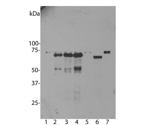 Western blot analysis of untransfected primary mouse neuron and glia cell cultures (lane 1), the same cells transduced with human ubiquilin 2 wild type (lane 2), with ubiquilin 2 P506T mutant (lane 3), with ubiquilin 2 P497S mutant (lane 4), with enchanced GFP control (lane 5), in HeLa cells (lane 6) and 3T3 cells (lane 7).