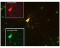 Co-localization of calretinin (green) and visinin (red) in retinal neuron visualized by Immunocytochemistry. Rat retinal primary cells (QBM cat# R-Ret-508) were cultured for 7 days. Image courtesy of QBM Cell Science.