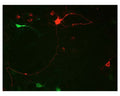 Staining of calretinin (red) and VILIP1 (green) positive neurons by Immunocytochemistry in rat retina culture. Rat retinal primary cells (QBM cat# R-Ret-508) were cultured for 7 days. Image courtesy of QBM Cell Science.