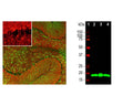 Left: VILIP-1 staining of rat cerebellum section by Immunohistochemistry. Section was stained with mouse antibody to VILIP-1 (red, 1:500) and rabbit antibody to GFAP (R-1374-50, green, 1:5,000). Blue: DAPI nuclear stain.IHC Method: Following transcardial perfusion of rat with 4% paraformaldehyde, brain was post-fixed for 24 hours, cut to 45 um, and free-floating sections were stained. The VILIP-1 antibody reveals protein expressed in granule cell membranes and in synapses in the white matter and molecular layers of the cerebellum. The GFAP antibody stains the processes of Bergmann glia and astroglia. Right: Western blot analysis of VILIP-1 expression (green, 1:1,000) in tissue lysates. [1] protein standard, [2] rat brain [3] rat cerebellum, and [4] mouse brain. The band at around 20 kDa corresponds to VILIP-1 protein.