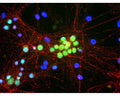 Rat brain cultures stained with M-1688-100 (green) and rabbit anti-NF-M (red, R-1395-50). The blue stain reveals DNA in the nuclei of these cells.