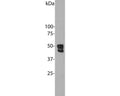 Extract from mouse brain. The antibody recognizes the ~48 kDa and 46 kDa proteins.