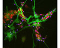 Mixed neuron/glial cultures stained with M-1693-100 (green) reveals strong cytoplasmic staining in astrocytes and our rabbit antibody to NeuN/FOX3 (R-3770-100) which shows nuclear and distal cytoplasmic staining in neuron cells and is completely absent in the astrocytes The blue stain reveals DNA in the nuclei of these cells.