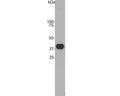 Crude bovine cerebellum homogenate. The antibody recognizes the 40 kDa protein.