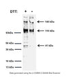 Western blot of TrkA in rat PC12 cell lysates (30 µg/lane). M-1719-100 detects membrane-associated TrkA full-length protein at 140 kDa (gp140TrkA), the glycosylated immature form of TrkA at 110 kDa (gp110TrkA) and an intracellular cleavage product at 41 kDa (p41, see Cabrera et al., 1995; Rossi et al., 2002). SDS-PAGE: denatured, reduced and non-reduced; Transfer: Tris-Glycine buffer; Membrane: nitrocellulose (0.45 µm); Blocking: 5% skim milk in TBST, 2 hours at RT; Primary antibody: overnight at 4°C (3 µg/mL); Secondary antibody: anti-mouse-HRP (1/6000) 2 hours at RT; Detection: Chemiluminiscence.