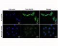 Immunofluorescence analysis of TrkA expression on human SHSY-5Y neuroblastoma cell membrane. Fixed (4% formaldehyde), non-permeabilized, and blocked (10% normal horse serum) SHSY-5Y cells were incubated with TrkA antibody M-1723-100 (extracellular domain, 2 µg/mL, green) for 1 hour. Primary antibody binding was visualized with a secondary donkey anti-mouse-CF488A antibody (4 µg/mL, 1 hour incubation). Cell nuclei were stained with Hoechst dye (blue). Magnification: 100x.