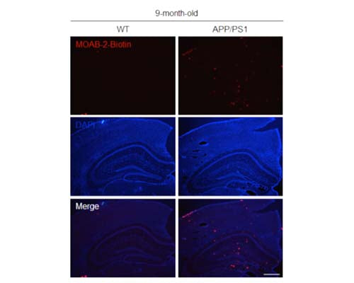 Immunohistochemical detection of amyloid plaques in the brain of 9 months old WT and APP/PS1 mice. Brain tissues were fixed with 4% paraformaldehyde and dehydrated in 30% sucrose solution. 30 µm frozen sections were prepared and blocked in 5% Normal horse serum at room temperature for 1h. Then, sections were incubated with biotinylated MOAB-2 antibody (1:1000, red), overnight at 4°C. MOAB-2 binding was visualized with a streptavidin-Cy3 conjugate (1:1000, 1h). Cell nuclei were counterstained with DAPI dye. Figure courtesy of Dr C.S. Ruan, University of South Australia.