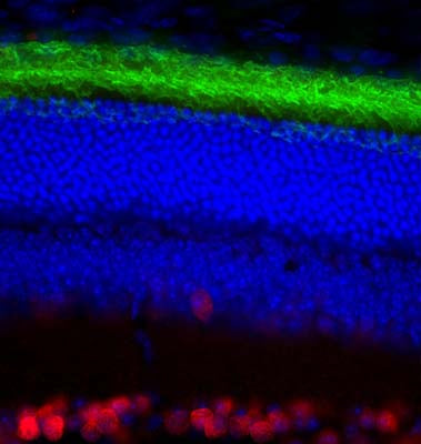 Left: Pig retinal section stained for rhodopsin by Immunohistochemistry with mouse antibody to Rhodopsin (green). Rhodopsin is most abundant in the rod outer segments (ROS) of retina, clearly localized in rod membranes. The rod inner segments (RIS) and rod nuclei in the outer nuclear layer (ONL) are also seen in this image. Nuclear DNA was stained with DAPI (blue). Right: Western Blot of bovine retinal extract probed with mouse antibody to Rhodopsin. The antibody stains a band corresponding to retinal rhodopsin at about 35 kDa. Higher molecular weight bands represent aggregated forms of rhodopsin.