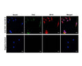 Membrane TrkC expression (green) in human HeLa cells, analyzed by Immunocytochemistry. Fixed (4% formaldehyde) and blocked (10% normal horse serum) HeLa cells were incubated with TrkC antibody M-1837-100 (2 µg/mL, green) for 1 hour. Cells were then permeabilized, blocked (10% horse serum, 0.1% Triton X-100) and incubated with rabbit NF-H antibody R-1389-50 (1:500, red) for 1 hour. Primary antibody binding was visualized with secondary donkey anti-mouse-CF488A and donkey anti-rabbit-CF568 antibodies (2 µg/mL, 1 hour incubation). Cell nuclei were stained with DAPI (blue). Negative control staining was performed under identical conditions with isotype control mouse antibody and rabbit whole serum from an non-immunized animal. Confocal imaging settings were the same for antibody and control staining. Magnification: 60x. Specific staining is observed for TrkC in the cell membrane, while the NF-H antibody reveals intracellular filaments.