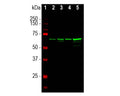 Analysis by western blot of NF-L expression in different tissue lysates with M-2112-50, Neurofilament light polypeptide (NF-L), Clone 7D1, Mouse mAb, (green, 1:5,000) with strong banding at 68-70kDa corresponding to the NF-L protein. Lane 1: protein standard (red); Lane 2: rat brain; Lane 3: rat spinal cord; Lane 4: mouse brain; Lane 5: mouse spinal cord.
