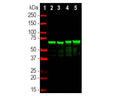 Analysis by western blot of NF-L expression in spinal cord lysates from different species with M-2114-50, Neurofilament light polypeptide (NF-L), Clone 6H112, Mouse mAb, (green, 1:5,000) with strong banding at 68-70kDa corresponding to the NF-L protein. Lane 1: protein standard (red); Lane 2: rat; Lane 3: mouse; Lane 4: pig; Lane 5: cow.