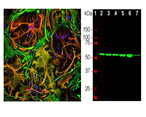 Left: Visualization of vimentin expression in rat cortical neuron-glial cell culture by Immunofluorescent analysis. Section was stained with mouse anti-Vimentin antibody, M-2121-100, (green, 1:5,000) and costained with rabbit polyclonal antibody to GFAP, R-1374-50, (red, 1:5,000). DAPI staining of nuclear DNA (blue). Vimentin is contained in fibroblastic, microglial and developing astrocytic cells which appear green. Maruting astrocytic cells appear red or yellow as they contain varying amounts of GFAP and vimentin.Right: Analysis by western blot of whole brain tissue lysates with M-2121-100 (green, 1:5,000) with band at approx. 50kDa. Lane 1: protein standard (red); Lane 2: HEK293; Lane 3: HeLa; Lane 4: SH-SY5Y; Lane 5: COS-1; Lane 6: C6; Lane 7: rat brain.