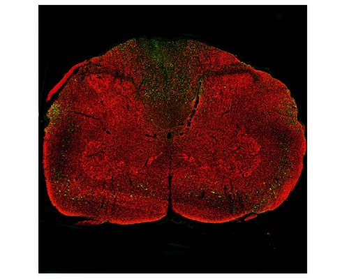 Image of an complete rat coronal section with a three-day-old midline C4 contusion injury by Immunofluorescence and Immunohistochemistry. The section was stained with M-2123-100, Neurofilament light polypeptide (NF-L), DG-Sensor™, Clone 1D44, Mouse mAb, (green), and co-stained with product R-2113-50, Neurofilament light polypeptide, C-terminus, (NF-L-Ct), Rabbit pAb, (red). Positive M-2123-100 staining is most visible in the dorsal columns, corticospinal tracts, and rubrospinal tracts; it is less common in the lateral and ventral funuculi; and it is least common but not entirely absent in the gray matter of the spinal cord. The presence of full length NF-L detected by our C-terminal rabbit NF-L antibody, R-2113-50, results in red staining of healthy neurons.