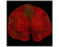 Image of a rat spinal cord section with a three-day-old midline C4 contusion injury by Immunofluorescence and Immunohistochemistry. The section was stained M-2128-100, Neurofilament light polypeptide (NF-L), Clone 1B11, Mouse mAb, (green), and co-stained with product R-2113-50, Neurofilament light polypeptide, C-terminus, (NF-L-Ct), Rabbit pAb, (red). Product M-2128-100 stains prominent aggregates of material concentrated in the lateral funiculi and dorsal columns, which are degenerating and degenerated axons caused by the C4 lesion. As product R-2113-50 antibody binds the C-terminal "tail" region of NF-L, which is absent or destroyed during degeneration, product M-2128-100 stains positively for degenerating NF-L profiles, but staining with R-2113-50 full-length NF-L is largely negative.