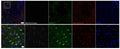 IF of a section of mouse brain NAc labeled with Anti-mCherry (1:1000, red), colabeled with eGFP, green, and DAPI staining of nuclear DNA. The Anti-mCherry specifically targeted the cpmApple-based membrane-localized red dopamine sensor co-expressed with eGFP in NAc and identified both cellular and subcellular distribution of the sensor. 20X/0.8 Air & 40X/1.1 Water Confocal, scale bar 100 um; 20 um. Donkey anti-chicken AlexaFluor647. Image from by Zikai Wang, Biomedical Engineering, USC.