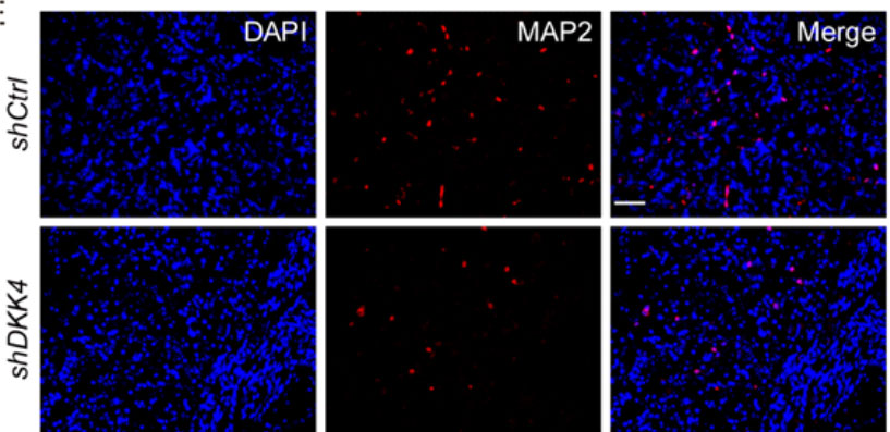 Anti-Microtubule-Associated Protein (MAP2) Antibody | MAP