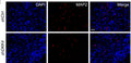 Representative images (E) and quantification (F) of MAP2 (Cat. MAP, red) immunofluorescence staining in xenografts dissected from nude mice harbouring 3117-shCtrl or 3117-shDKK4 intraperitoneally. Image from publication CC-BY-4.0. <a href="https://pubmed.ncbi.nlm.nih.gov/38519641/"