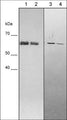 Western blot analysis of human recombinant osteopontin protein (lane 1 & 2) or human MDA-MB-231 cells (lane 3 & 4). The blots were probed with mouse monoclonal anti-Osteopontin (OM5741) at a dilution of 1:1000 (lane 1), 1:4000 (lane 2), 1:250 (lane 3), and 1:1000 (lane 4).