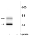 Western blot of rat brain lysate showing specific immunolabeling of the ~50 kDa α- and the ~60 kDa β-CaM Kinase II phosphorylated at Thr286 in the first lane (-). Phosphospecificity is shown in the second lane (+) where the immunolabeling is completely eliminated by blot treatment with lambda phosphatase (λ-Ptase, 1200 units for 30 minutes). 