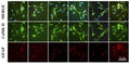 Astrocytes (1 × 106 cells/ml) were cultured for 24 h without treatment or with METH (10 μM), clade B gp120 (50 ng/ ml), or clade C gp120 (50 ng/ ml) alone or METH in combination with clade B or C gp120. After incubation, the cells were fixed, permeabilized, and stained for (A) DRD-2, (B) phospho-CaMK II (Cat. p1005-286) (C) phospho-CaMK IV (green) or GFPA (red) and DAPI (blue). The cells were imaged using a confocal microscope at 630x
