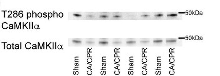 Western immunoblot measuring levels of T286 phosphorylation of CaMKII (cat no p1005-286,1:1000) normalized to total CaMKII in the membrane fraction of whole hippocampi from sham and CA/CPR operated mice. Image for publication, CC-BY-4.0. PMID: 38565288.