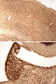 Immunolabeling of mouse cerebral cortex (top) and habenula (bottom) brain sections labeled with anti-phospho-ser133 CREB (Cat. p1010-133, DAB, 1:100). These images were kindly provided by Dr. Anton Reiner, Univ. of Tennessee Health Science Center (Memphis, TN).