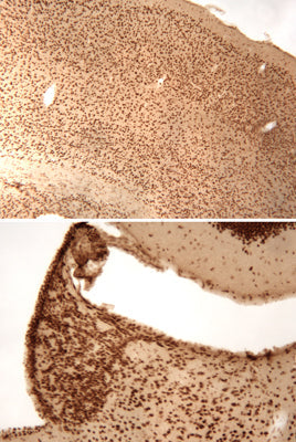 Immunolabeling of mouse cerebral cortex (top) and habenula (bottom) brain sections labeled with anti-phospho-ser133 CREB (cat. p1010-133, DAB, 1:100). These images were kindly provided by Dr. Anton Reiner, Univ. of Tennessee Health Science Center (Memphis, TN).