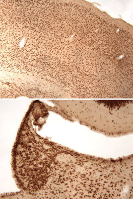 Immunolabeling of mouse cerebral cortex (top) and habenula (bottom) brain sections labeled with anti-phospho-ser133 CREB (cat. p1010-133, DAB, 1:100). These images were kindly provided by Dr. Anton Reiner, Univ. of Tennessee Health Science Center (Memphis, TN).
