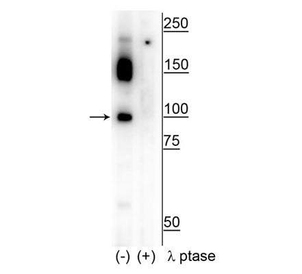 Western blot of human T47D cell lysate showing specific immunolabeling of the ~100 kDa CtIP phosphorylated at Ser326 in the first lane (-). Phosphospecificity is shown in the second lane (+) where immunolabeling is completely eliminated by blot treatment with lambda phosphatase (λ-Ptase, 1200 units for 30 min).
